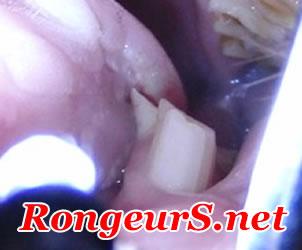 Digestif: Spicules dentaires Ulceres de la langue