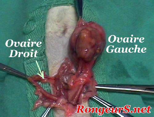 most cancers cerveau foie poumon