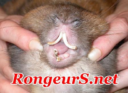 Digestif: Malocclusion dentaire des incisives operation